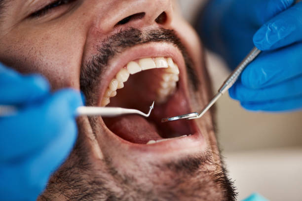 Best Emergency Dentist for Knocked-Out Tooth in Kingfisher, OK
